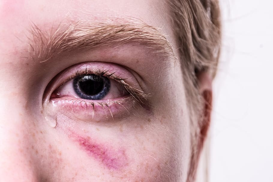 trauma-injured-violent-tear.jpg
