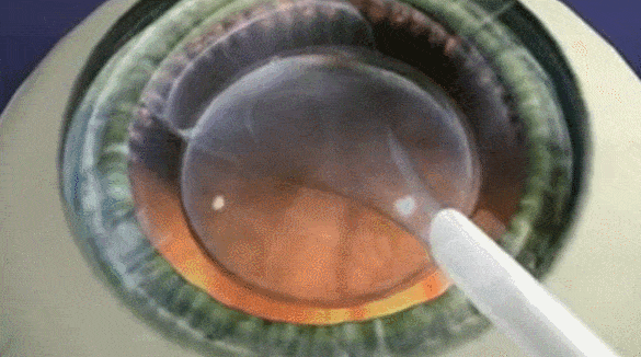 微信图片_20250625114911.gif